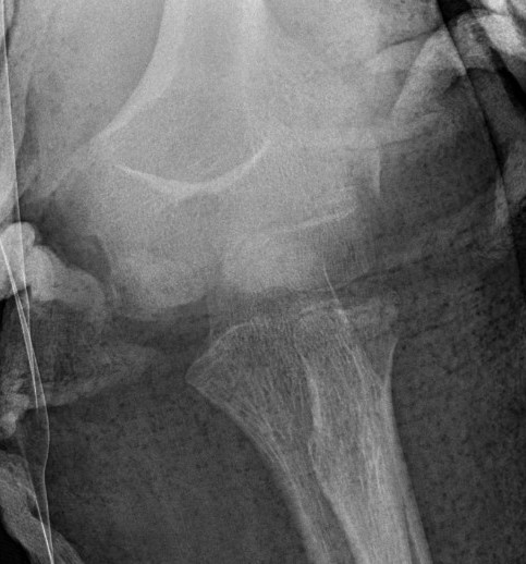 med epi