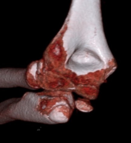 med epi