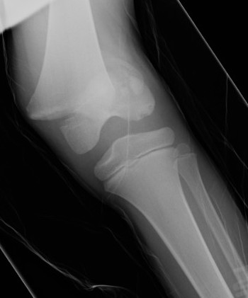 SH1