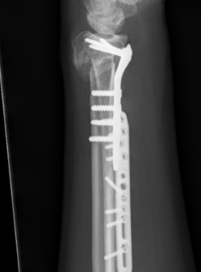 DR osteot