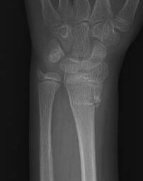 DR