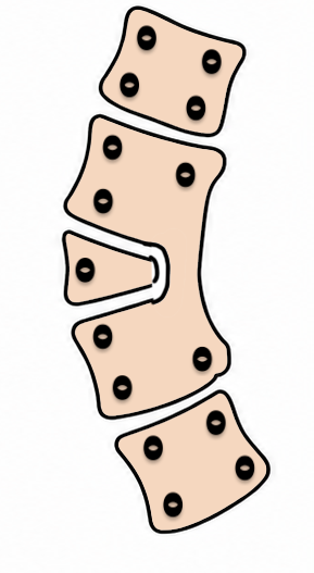 congenital