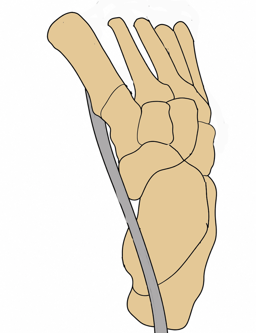Dynamic supination