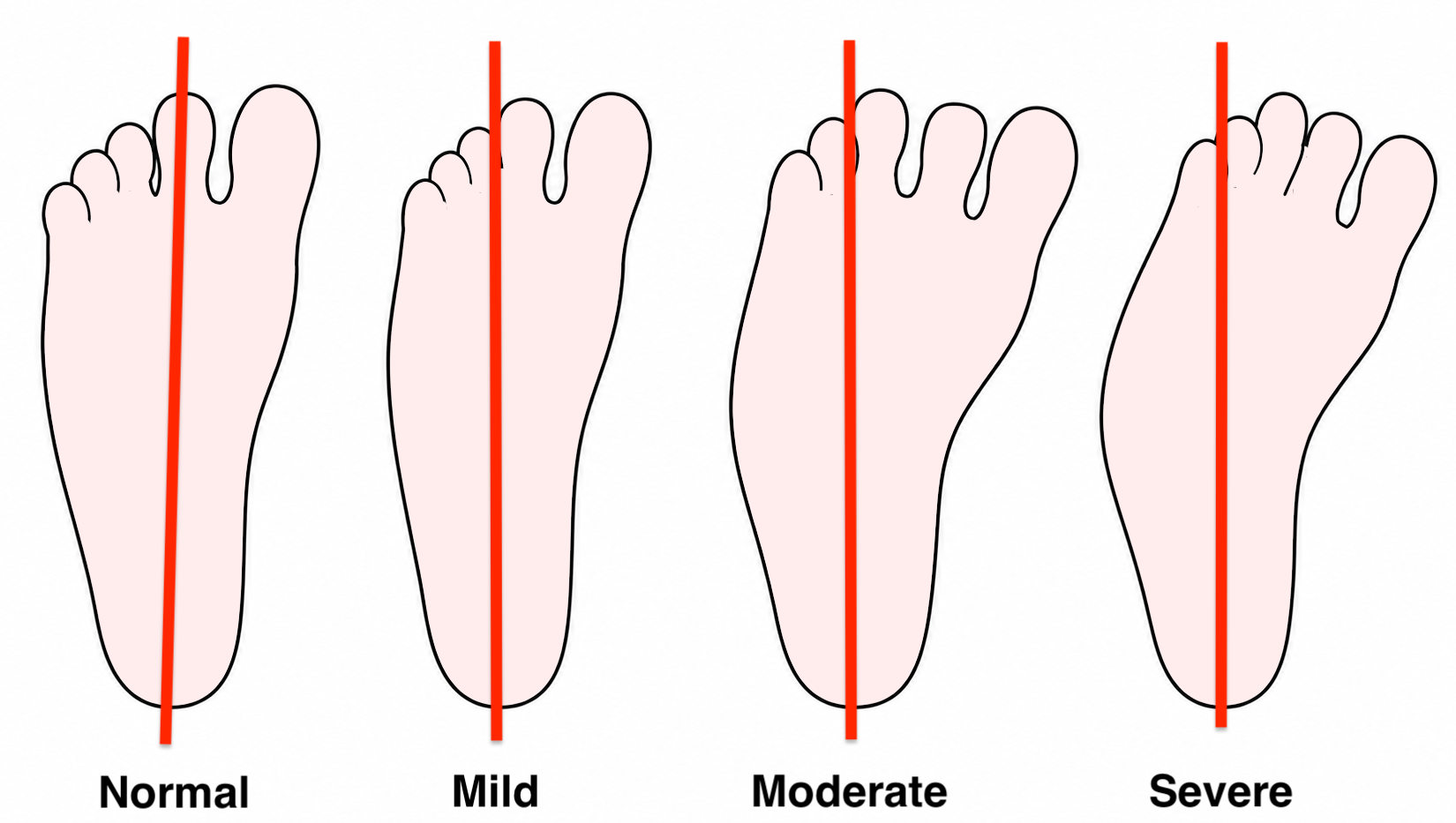 Blecks classification