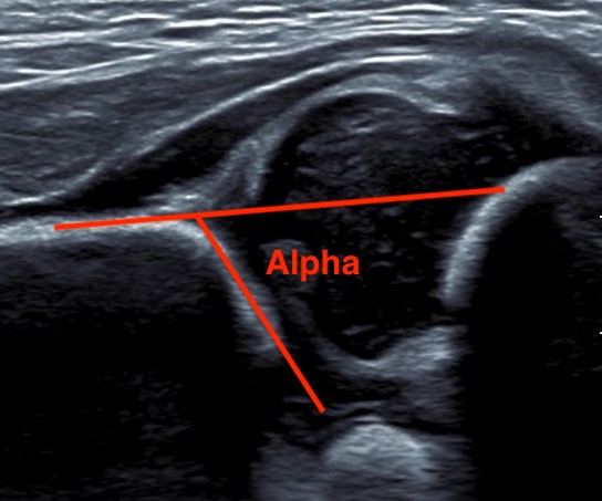 Alpha