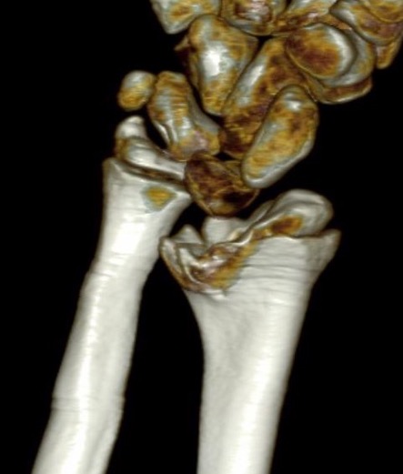 dr