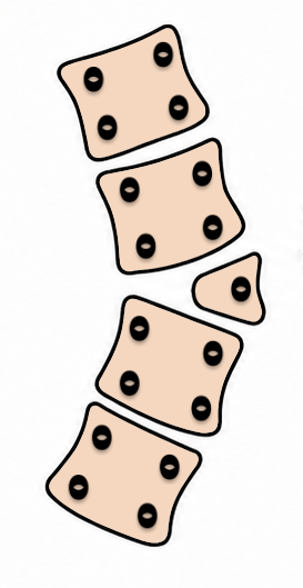 congenital