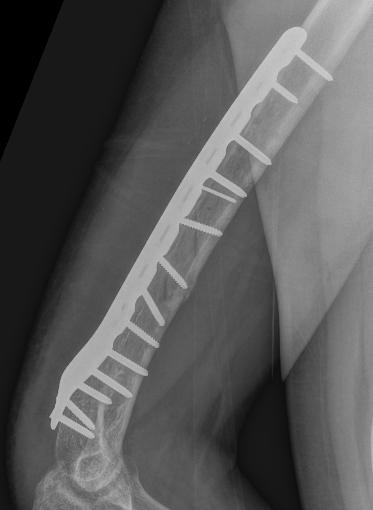 Nonunion