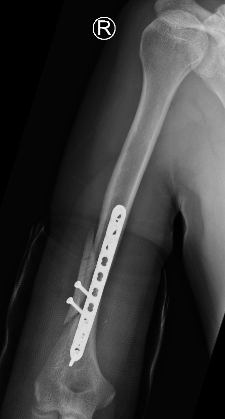 Nonunion
