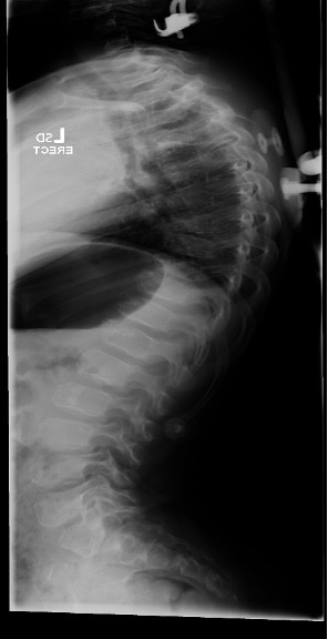 SED Spine 