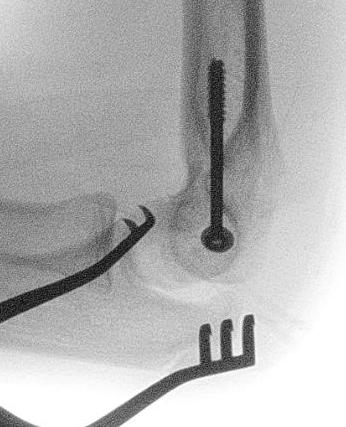 Med epi