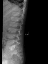 SED spine