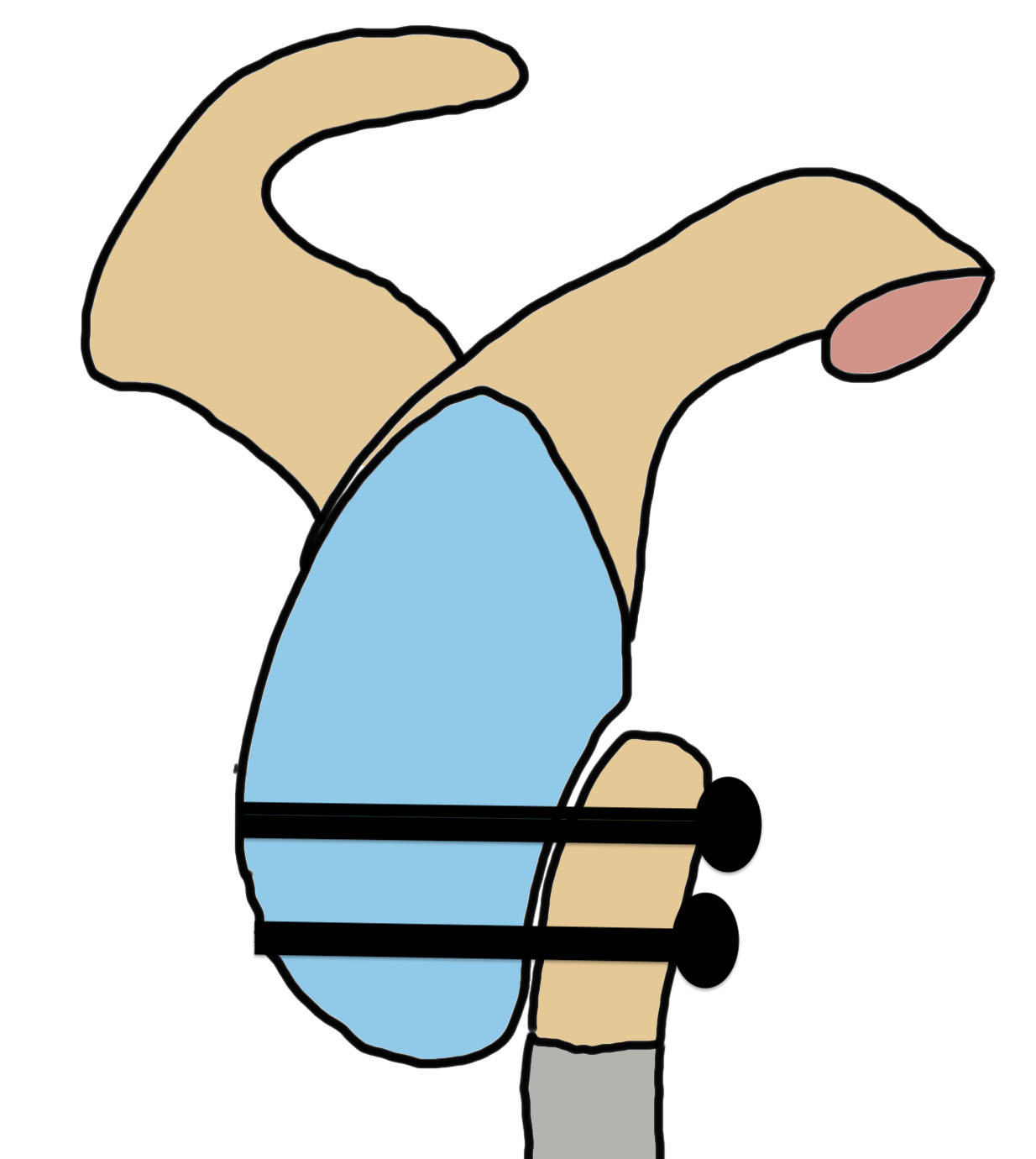 latarjet