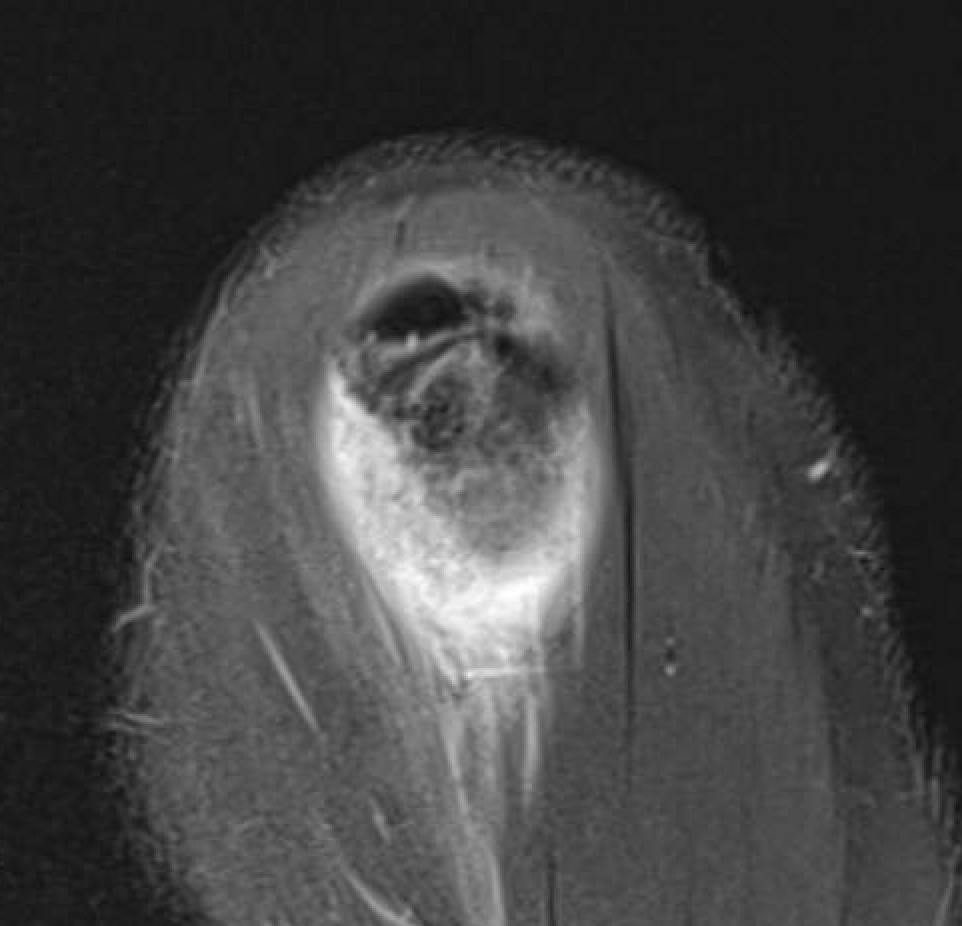 caclum