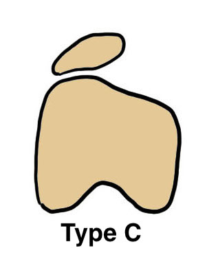 Type C