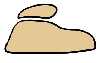 Trochleoplasty