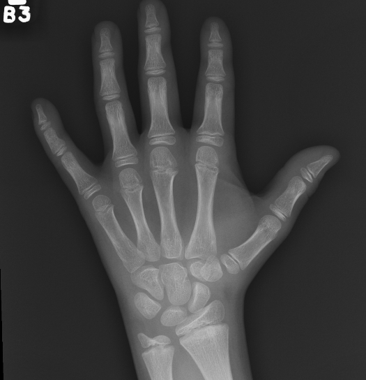 Left hand