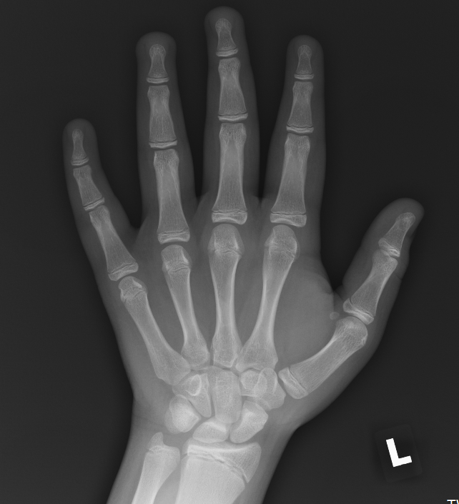 left hand