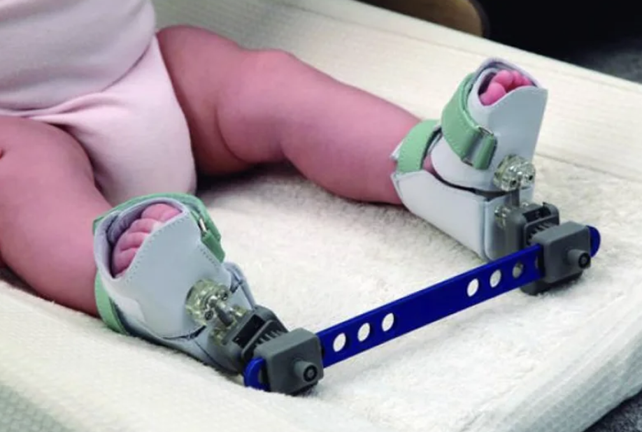 Bebax orthotics