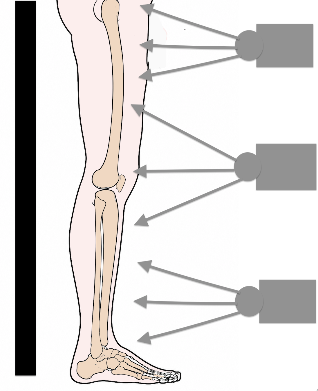 xray