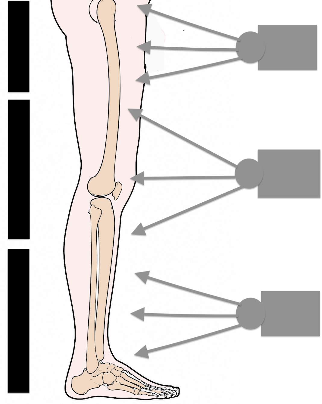 xray
