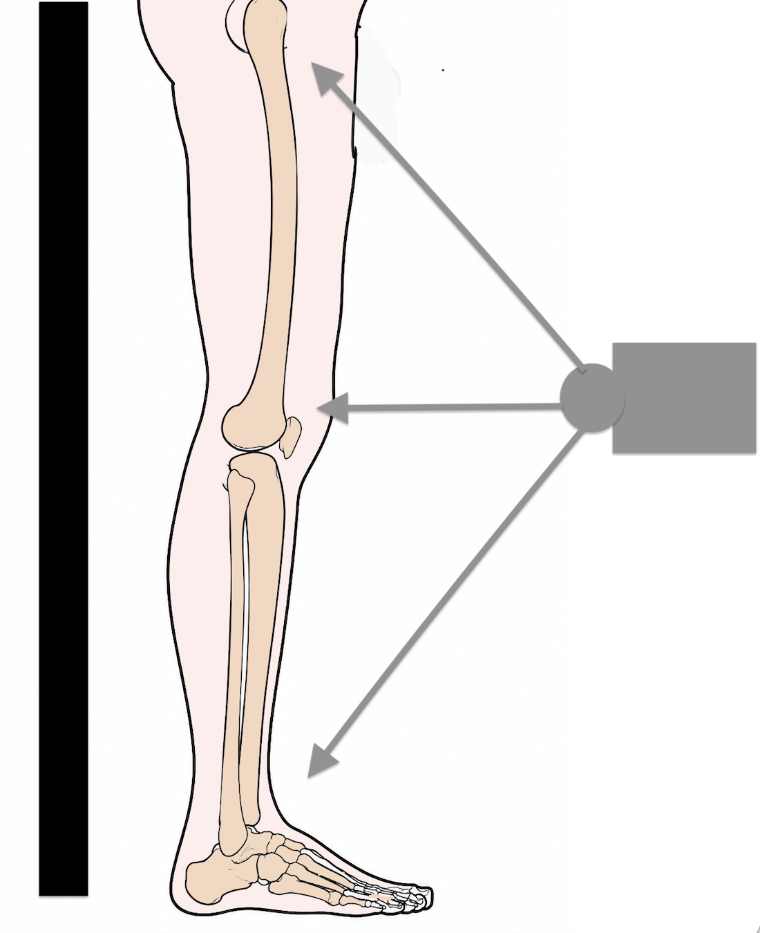 xray