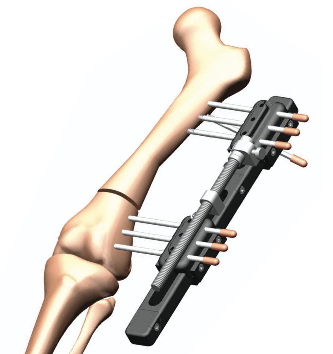 Monolateral external fixator