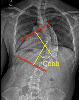 Cobb