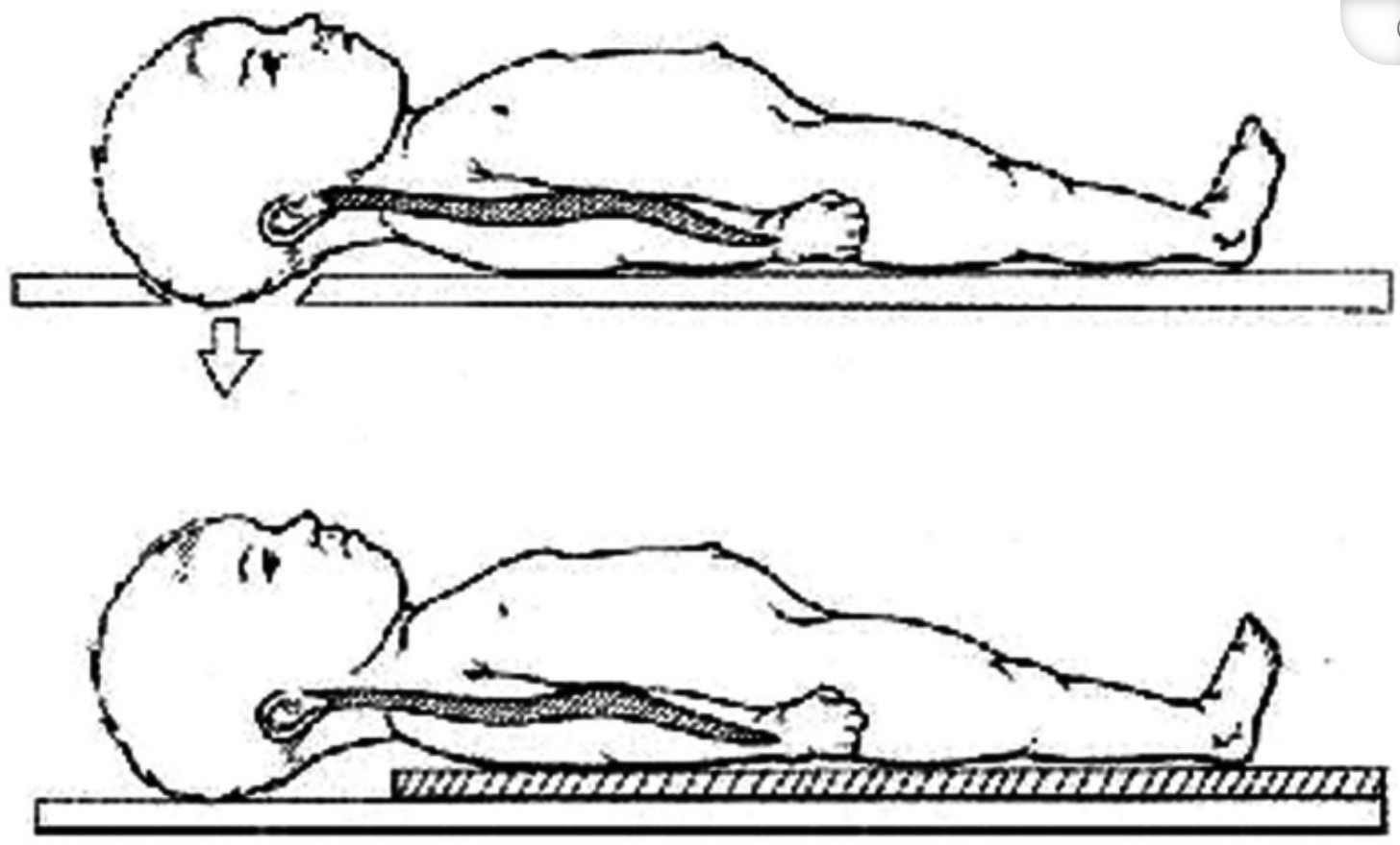 Immobilization