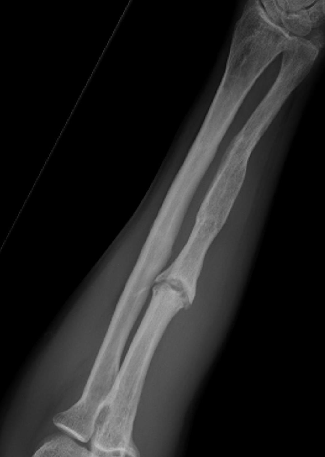 Nonunion