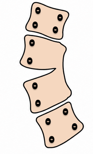 congenital