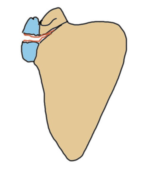 glenoid