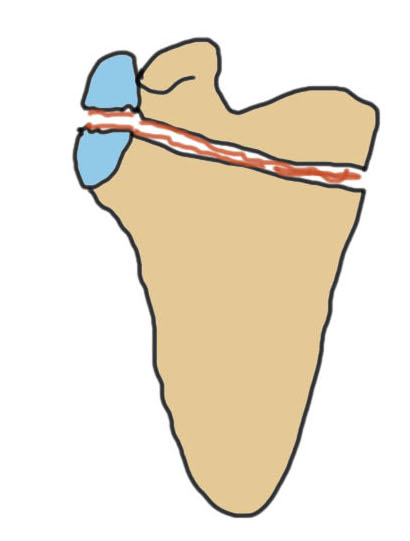 glenoid