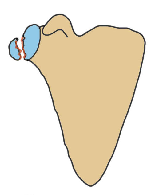 glenoid