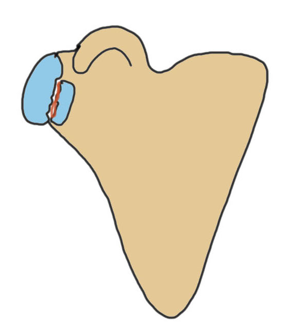 glenoid