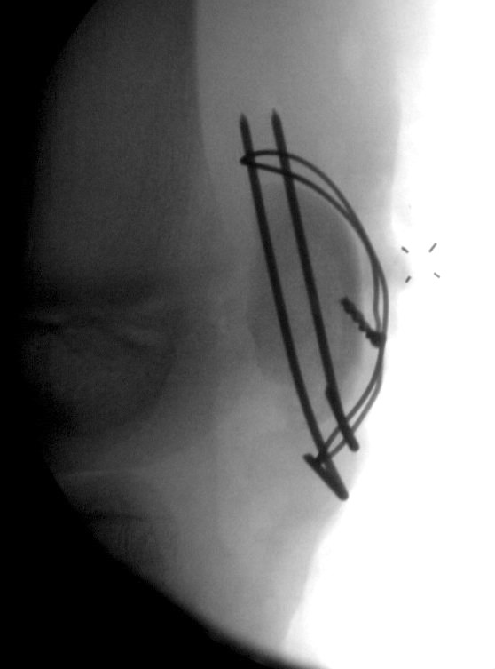 sleeve