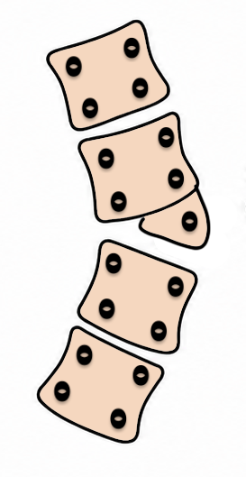 congenital