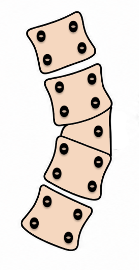 Congenital